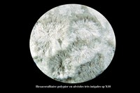 Hexacoralliaire en alvéoles sp